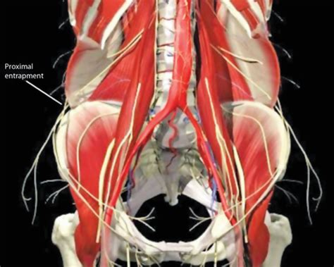 Ilioinguinal and Iliohypogastric Nerve Blocks | Atlas of Pain Medicine ...