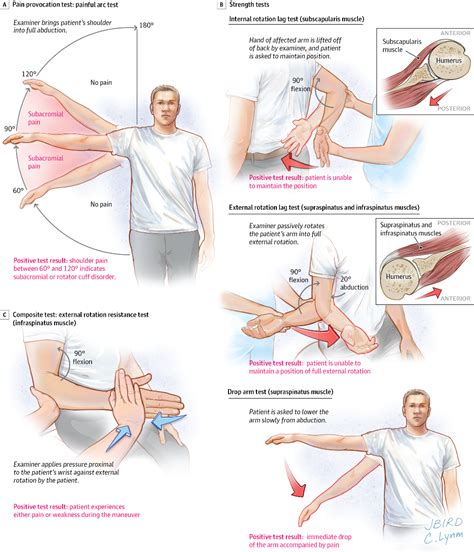 Pin by melmomo on Therapy | Rotator cuff, Shoulder pain, Physical therapy