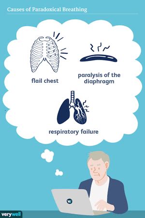 Flail Chest: Causes, Symptoms, Diagnosis, and Treatment