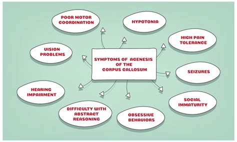 23 Corpus Callosum Agenesis Images, Stock Photos, 3D objects, & Vectors | Shutterstock