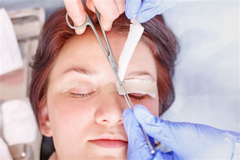 Blepharoplasty or Eyelid Surgery | Insight Vision Center