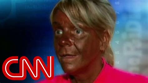 'Tanning mom' turns 'weird and pale' - YouTube