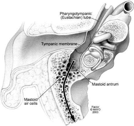 Mastoid Air Cells Diagram