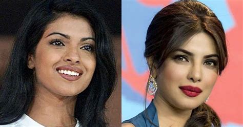 Priyanka Chopra Recalls The Botched Nose Job That Changed Her Look ...