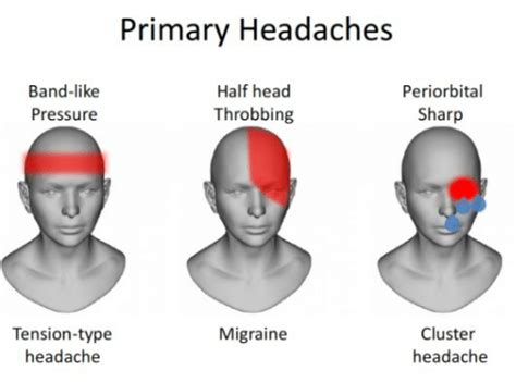 How To Understand Frequent Headaches Is An Indication For Brain Tumor - Multispeciality Hospital ...