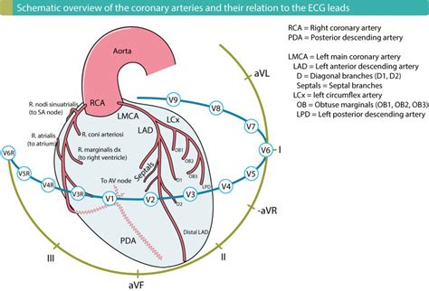 Cardiac thromboembolism: cardiac sources of embolism – Cardiovascular Education