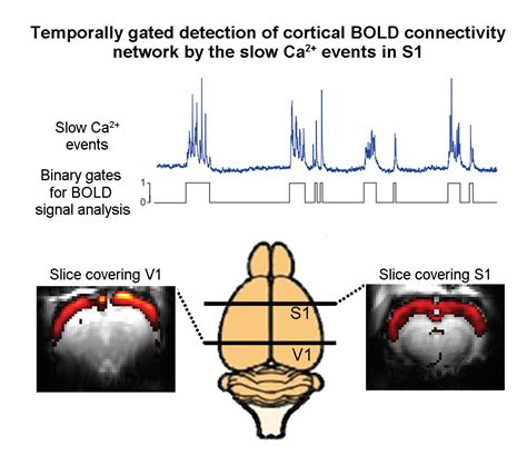 Functional MRI: Making connections in the brain | eLife