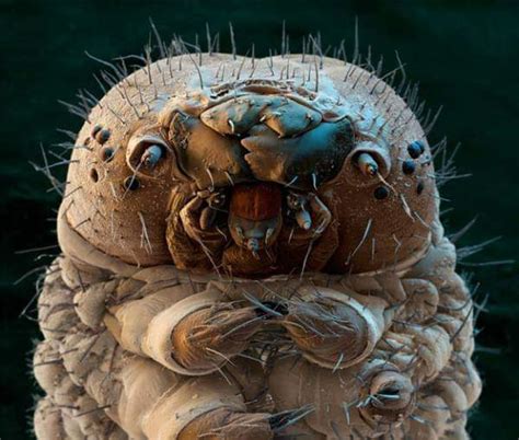 Demodex Eyelash Mites