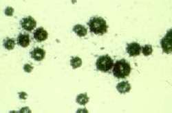 Ureaplasma urealyticum