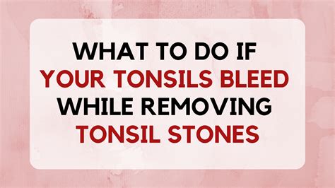 Bleeding Tonsils: What To Do If Your Tonsils Bleed While Removing Tonsil Stones - TonsilStoneCure