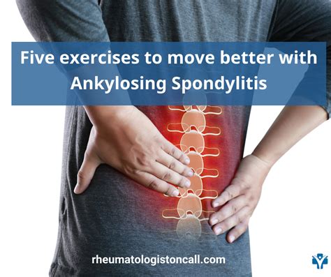 Five Exercises to move Better with Ankylosing Spondylitis