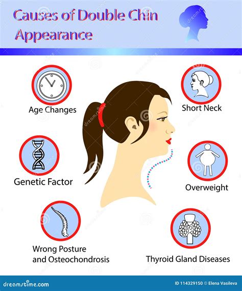 Causes of double chin stock vector. Illustration of medicine - 114329150