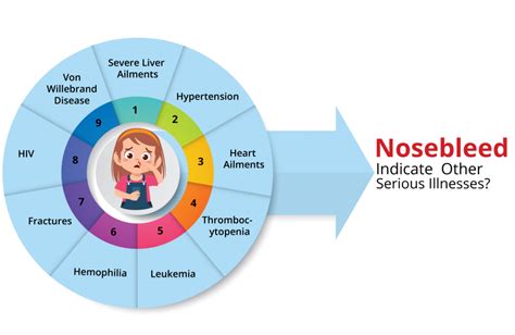 What Causes Nosebleeds with Blood Clots? | kayawell