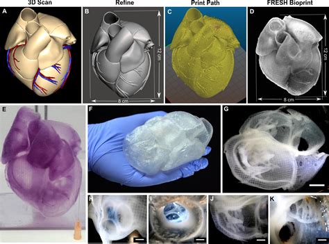 New Tool for Surgeons: 3D Bioprinted Heart