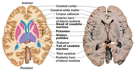 Neurovascular Medicine