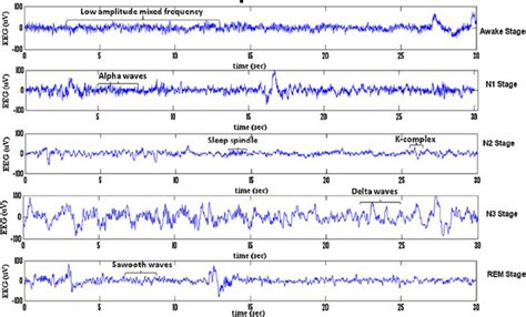 Frontiers | Detection of EEG K-Complexes Using Fractal Dimension of ...