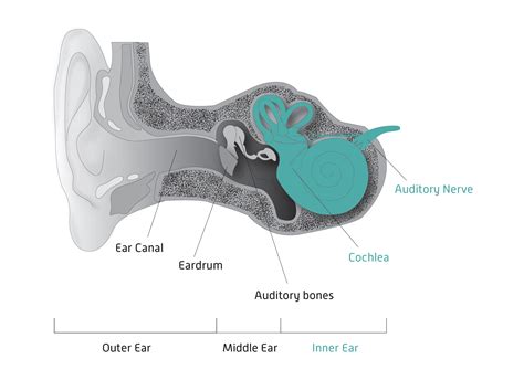 Types of Hearing Loss — Hearing Health Foundation