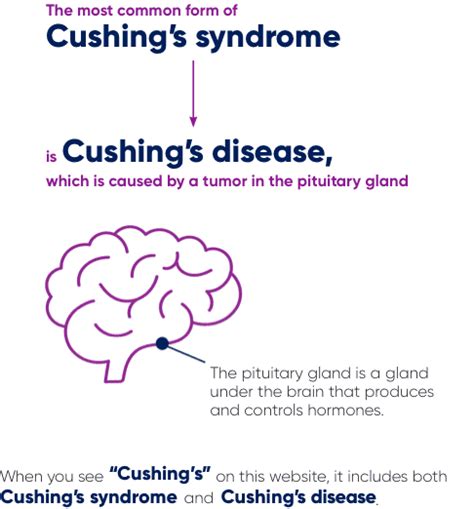 About Cushing’s Syndrome