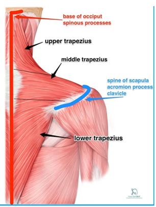 Trapezius Tear Signs Symptoms