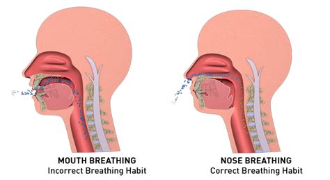 Mouth breathing vs Nasal breathing