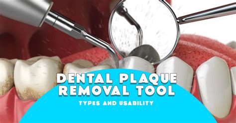 Dental Plaque Removal Tools - Types and Usability – Franklin Dental Supply