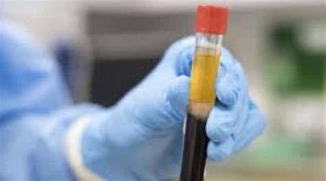 Plasma Therapy : A Miracle Or Over Hyped | InFeed – Facts That Impact