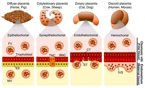 Placental classification based on the distribution of chorionic villi ...