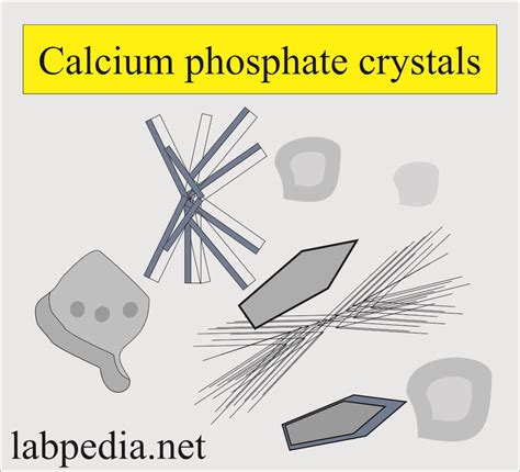 Amorphous Phosphate In Urine