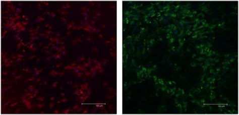 | expression of schwann-cell proteins in eBM-Mscs trans-differentiated... | Download Scientific ...