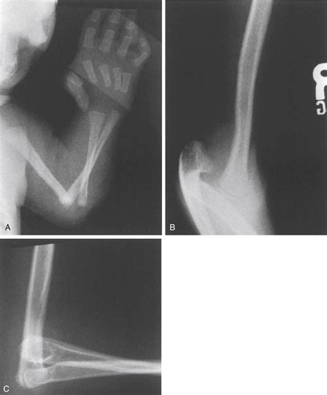 Orthopaedic-Related Syndromes - Clinical Tree