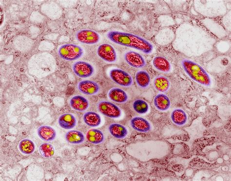 Mycobacterium avium lung infection, TEM - Stock Image - C032/2489 - Science Photo Library