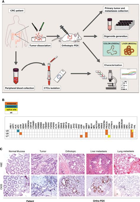 Frontiers | An Orthotopic Patient-Derived Xenograft (PDX) Model Allows the Analysis of ...