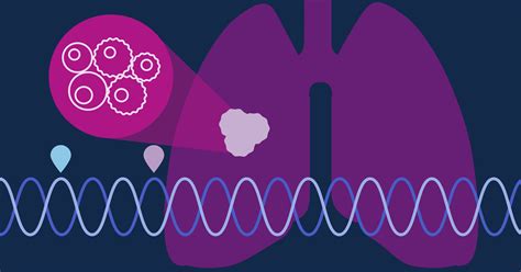 5 Reasons to Ask About Biomarker Testing After a Lung Cancer Diagnosis - Cancer Health