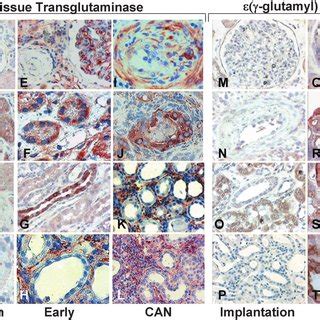 Insoluble tissue transglutaminase (tTg) (A to F) and (-glutamyl) lysine ...