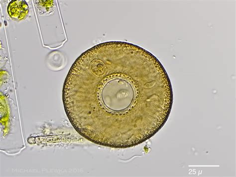 Freshwater and other micro-organisms from Germany: Protists (Protozoa) Rhizopoda, Arcella ...