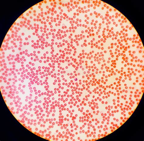 Human Blood Cells Under a Microscope Stock Photo - Image of blood, light: 85053122