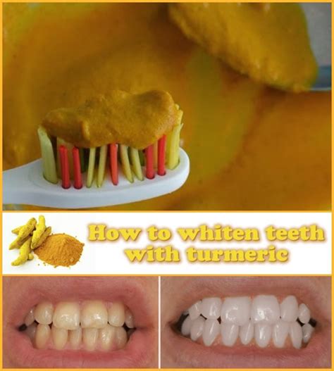 How to whiten teeth with turmeric - SHealthPlus