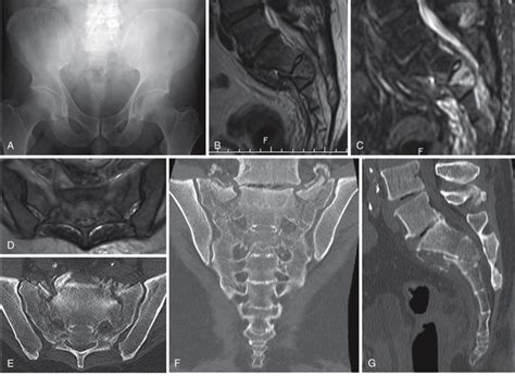 Inlet Outlet Pelvis Radiographic Positioning