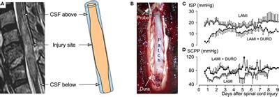 Frontiers | Acute Traumatic Spinal Cord Injury in Humans, Dogs, and Other Mammals: The Under ...