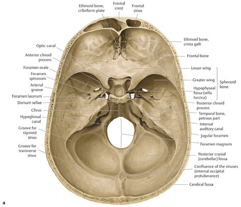 16 Skull Base and Cranial Nerves | Radiology Key