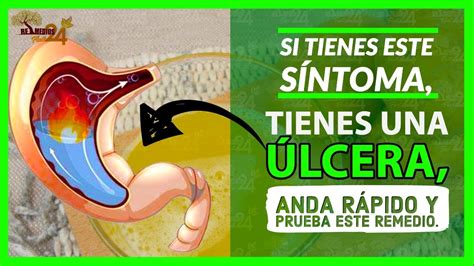 🍠SI TIENES ESTOS SÍNTOMAS, Tienes Una Úlcera Estomacal, Ve Y Prueba Este Remedio - YouTube