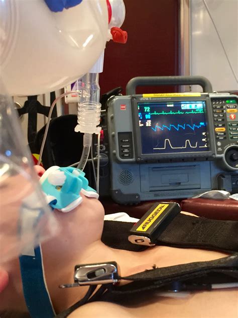 RescueDigest Resources: Capnography - Rescue Digest