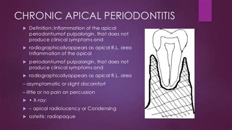 Pulp and periapical disease