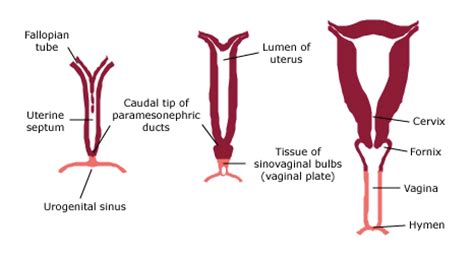 Obstructive Reproductive Tract Anomalies ScienceDirect, 50% OFF