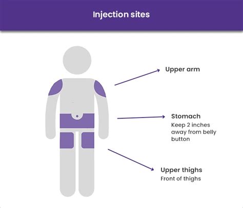 The Optimal Location for Administering Best Place to Inject Mounjaro ...