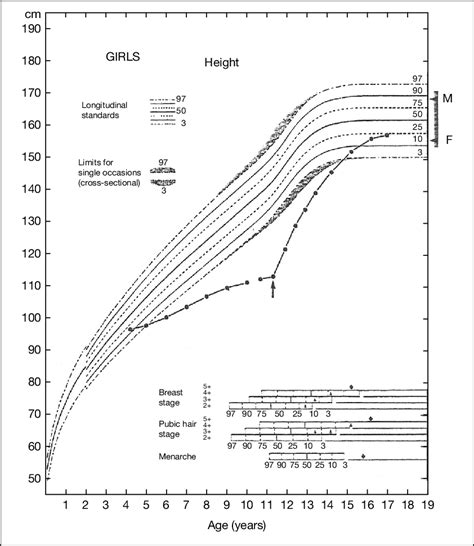 A child with growth hormone deficiency demonstrating catch-up growth... | Download Scientific ...