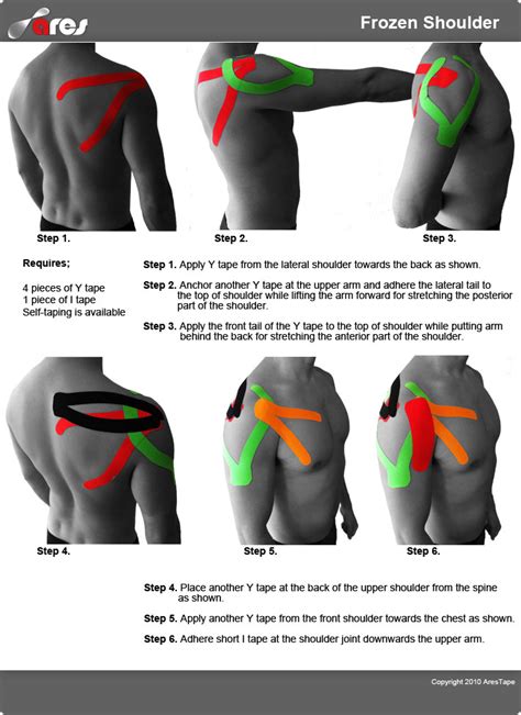 Frozen Shoulder Taping #ShoulderTreatment #FrozenShoulder #HowToApplyKtape #PhysioRelief ...