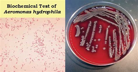 Biochemical Test of Aeromonas hydrophila