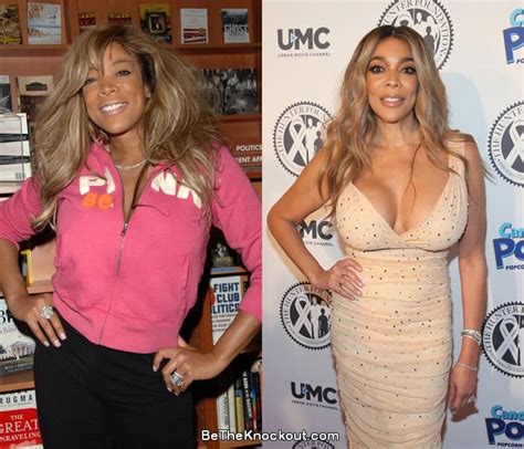 Wendy Williams Plastic Surgery Comparison Photos