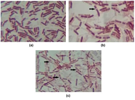 Images of endospore staining of (a) control, (b) OR + RL MIC 14h and... | Download Scientific ...